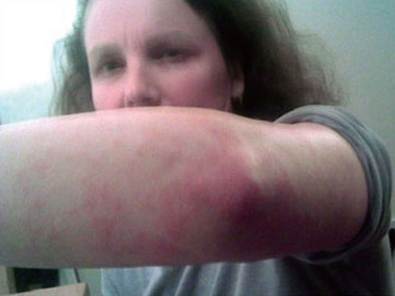 中國製沙發變成殺手毒害英倫上千人